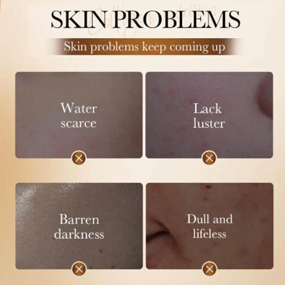 Diagram of skin problems with text labels on a beige background