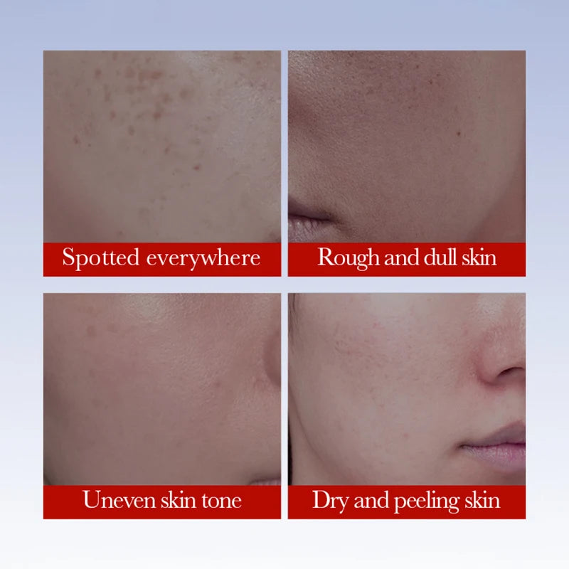 Collage of skin conditions with descriptive text on a light blue background