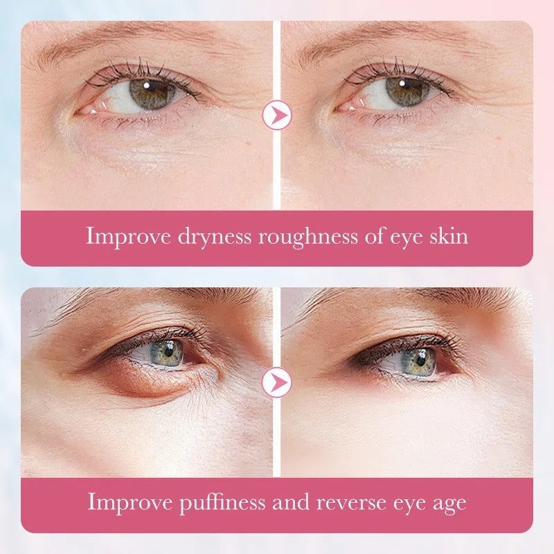 Before and after comparison of eye skin improvement with text on a pink background